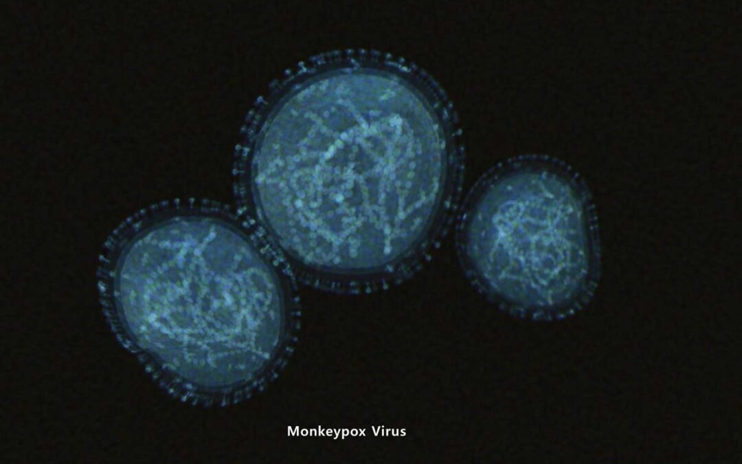 Aktuelle Fragen zur neuen Virusinfektion
