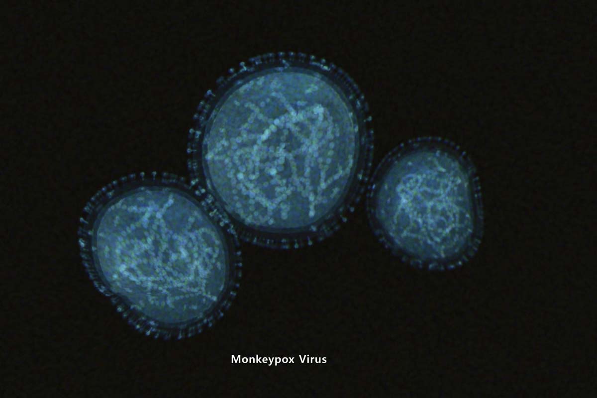 Abbildung des Affenpocken-Virus.
