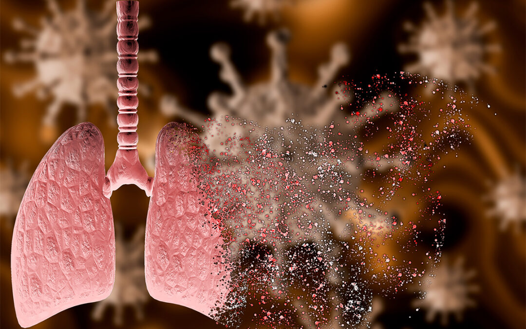 Ursache des coronabedingten Lungenversagens identifiziert