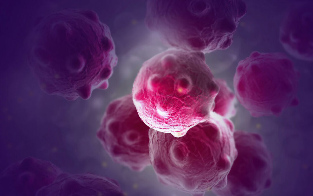 Wie Krebszellen auf alternative Nährstoffquellen umschalten