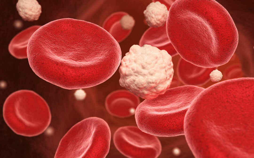 Wie die Verträglichkeit der Blutstammzelltransplantation verbessert werden kann