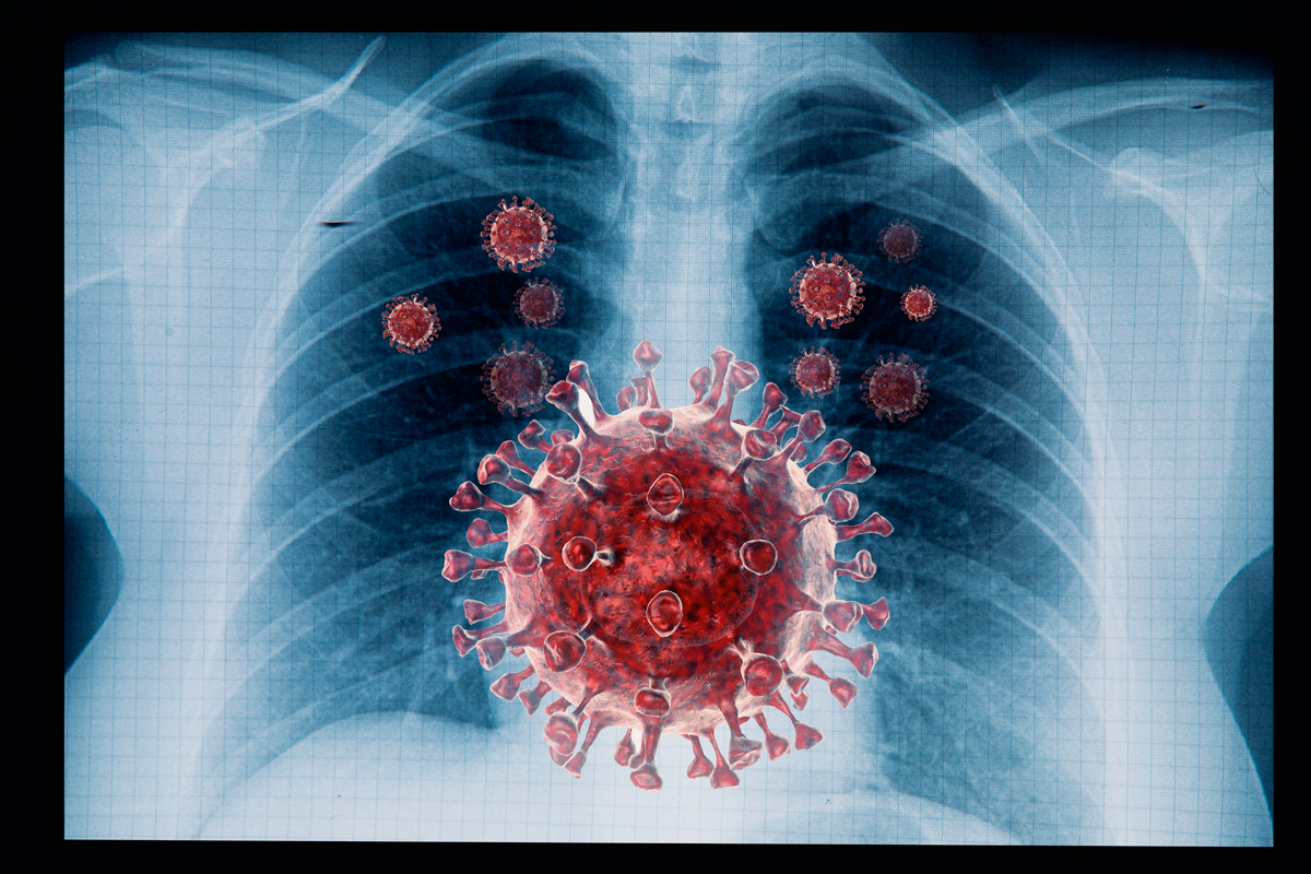 Coronavirus und Röntgenbild Brust
