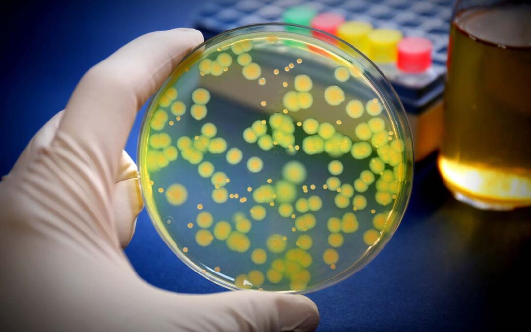 Neuer Wirkstoff zur Bekämpfung multiresistenter Bakterien in der Entwicklung
