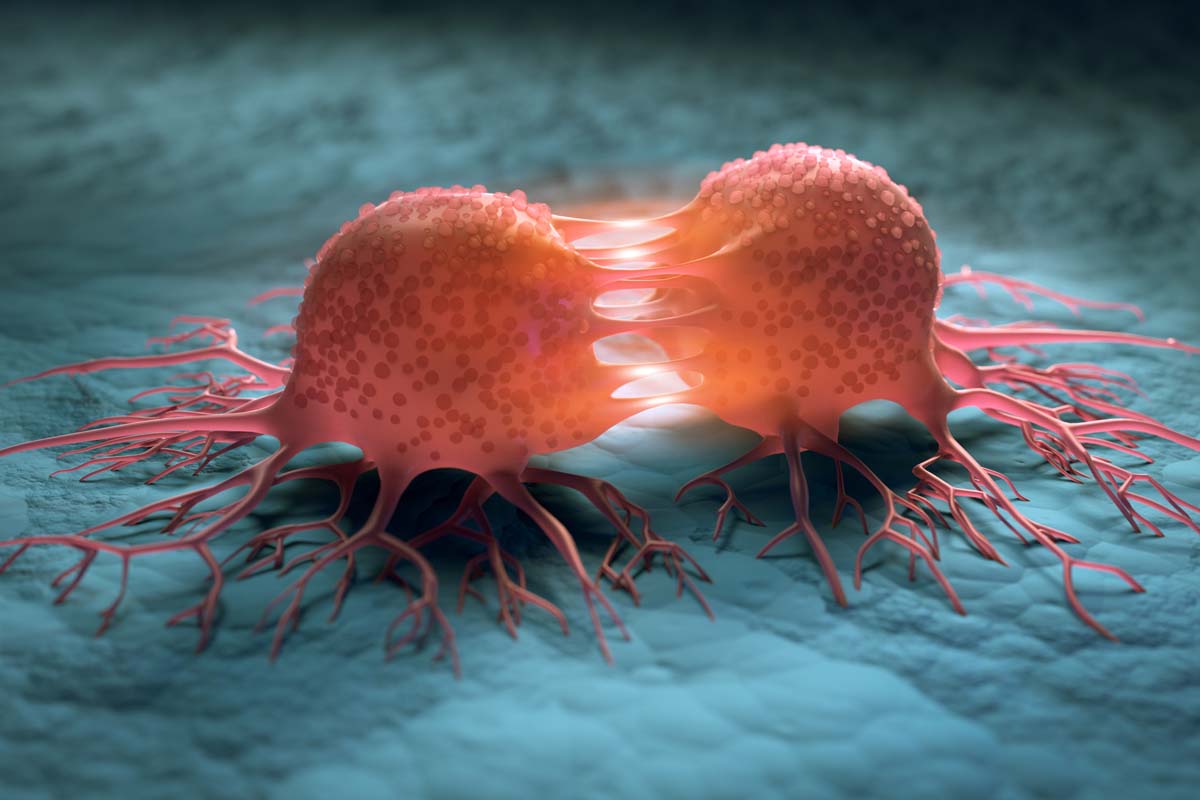 Abbildung von Krebszellen.
