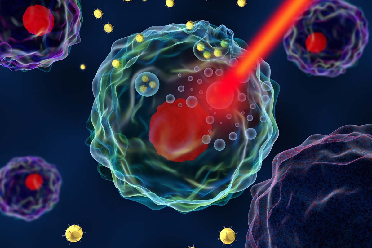 Schaubild Strahlung trifft auf Krebszelle.