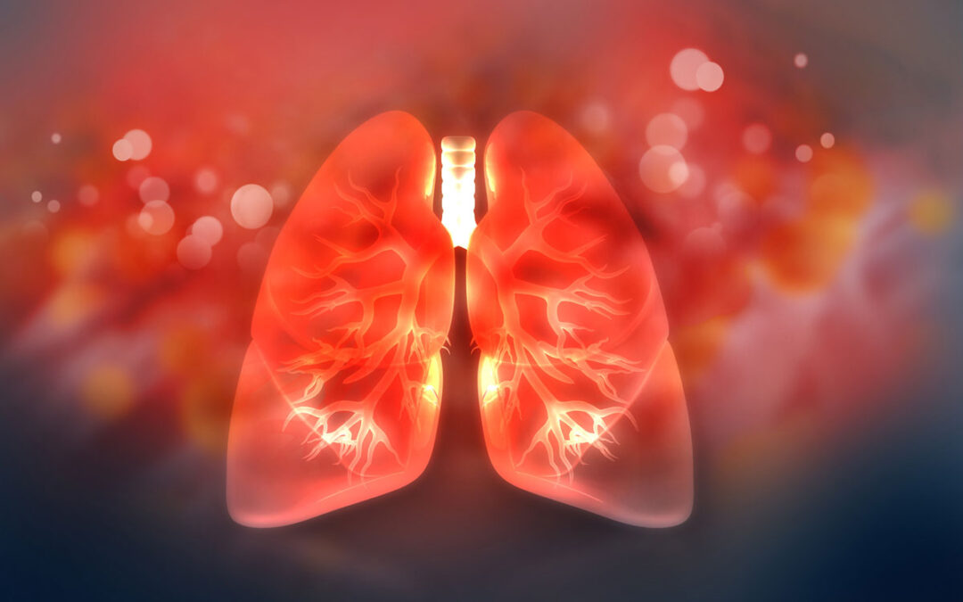 Bioprinting ermöglicht Untersuchung chronischer Lungeninfektionen