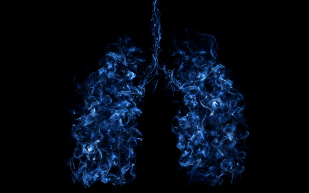 Bessere Früherkennung bei Lungenkrebs