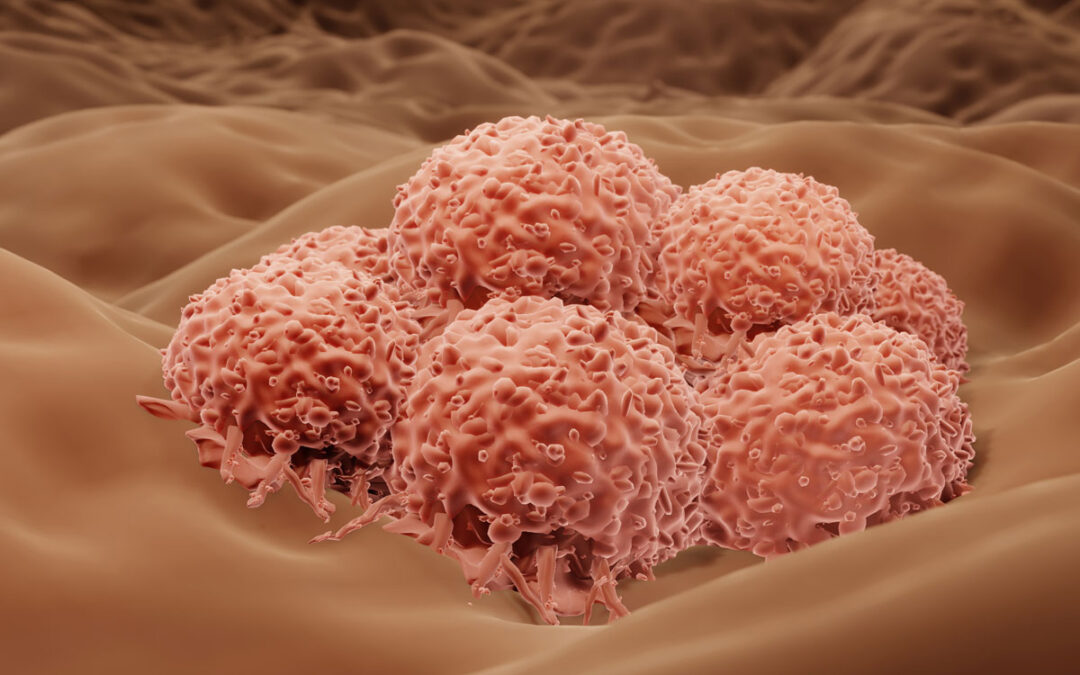 Zytokin beeinflusst Wirkung von Krebstherapie