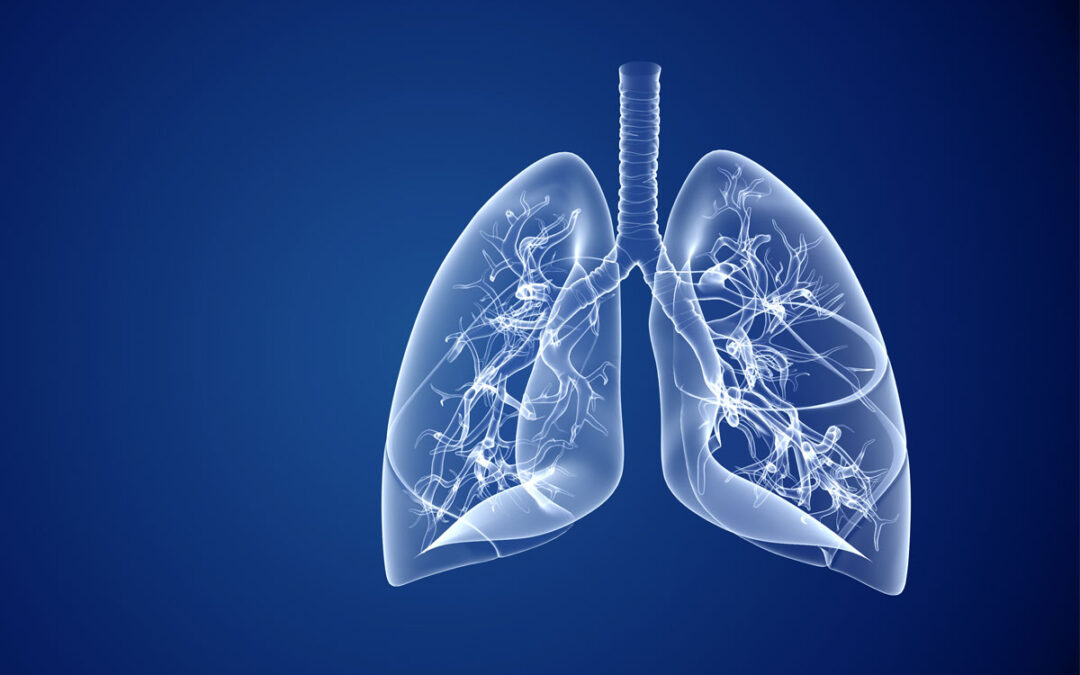 Durchbruch in der PCD-Therapie für bessere Lungenfunktion