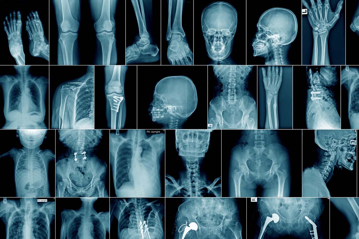 Röntgenbilder menschlicher Knochen.