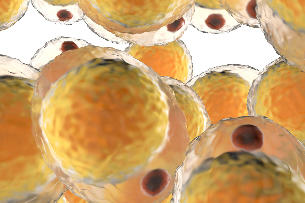 Cluster von Fettzellen
