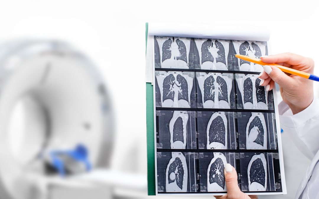 Neue CT-Technik liefert Einblicke in Struktur, Funktion und Durchblutung