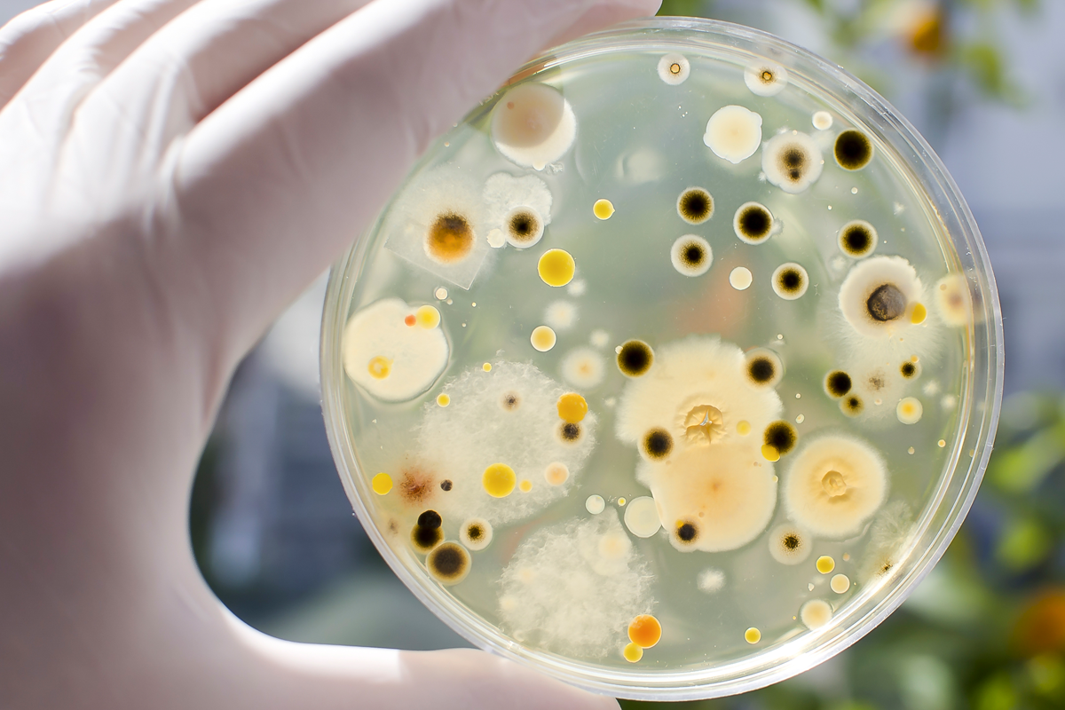 Petrischale mit Bakterien und Pilzkultur