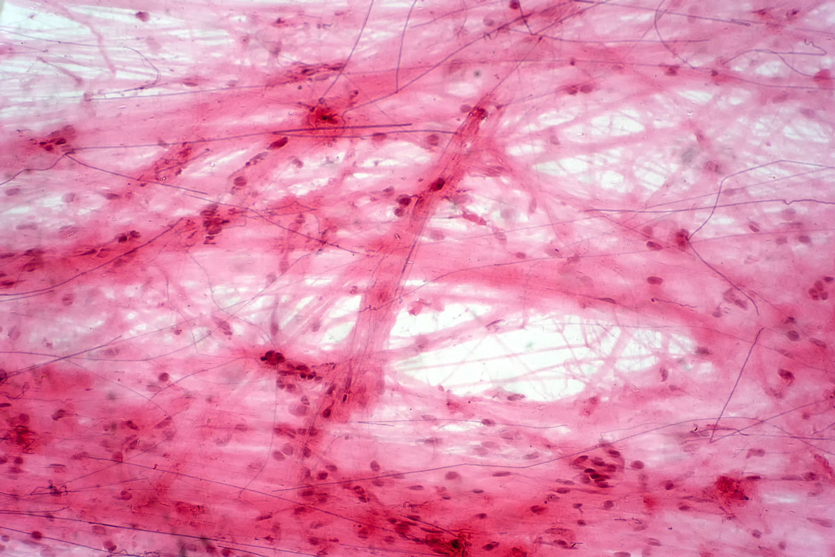 Bindegewebe unter dem Mikroskop