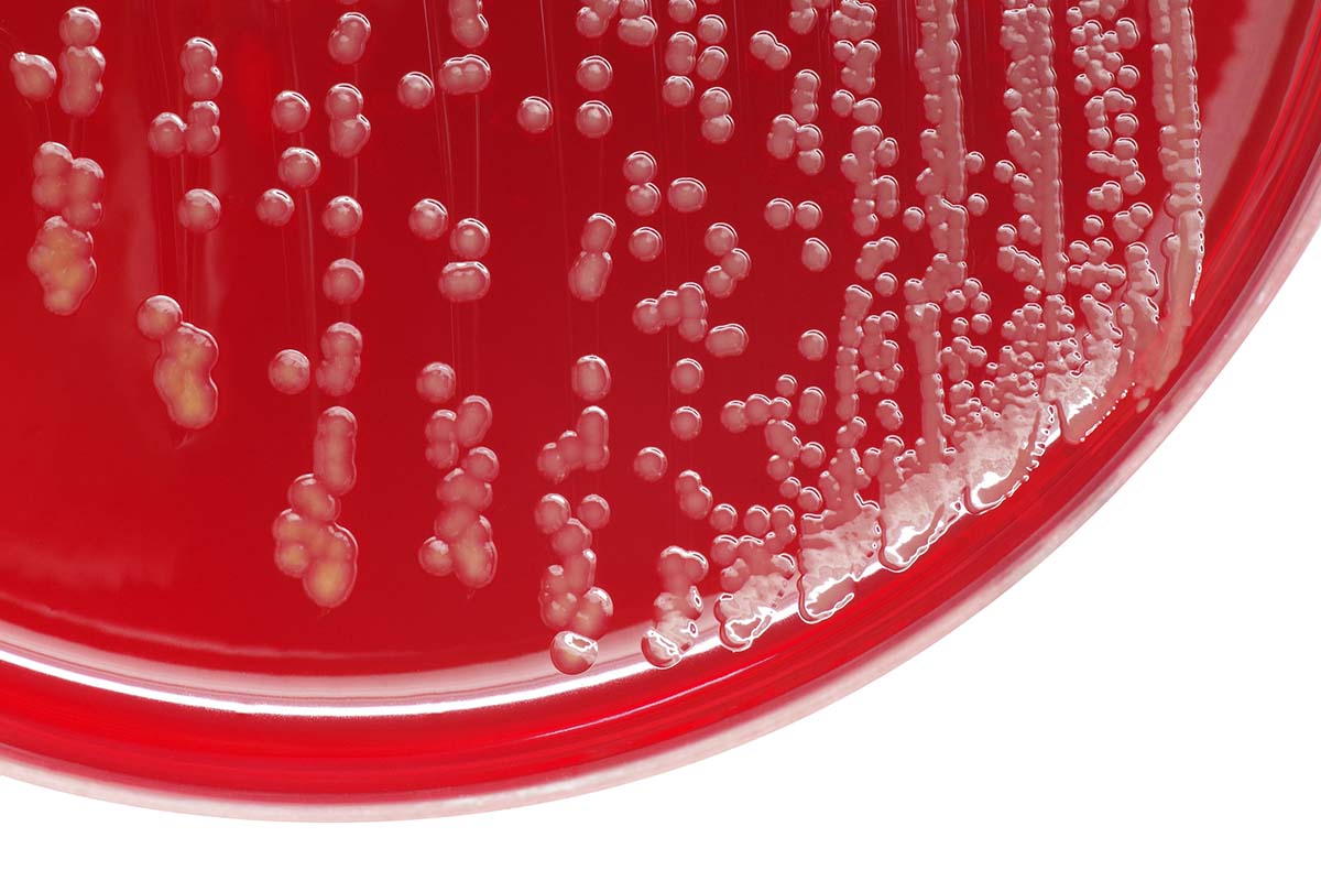 Bakterienkultur auf Petrischale