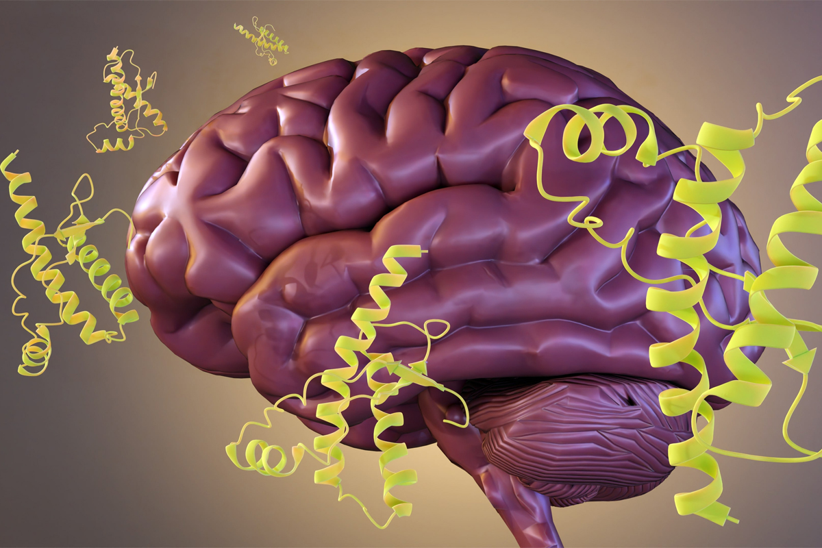 Prionen-Proteinmoleküle, die im menschlichen Gehirn verstreut sind