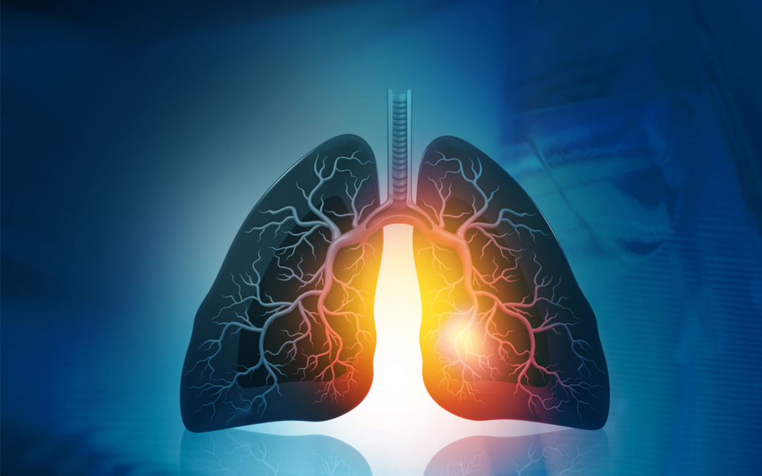 Wie ein Protein die Regeneration der Lunge nach Infektion unterstützt