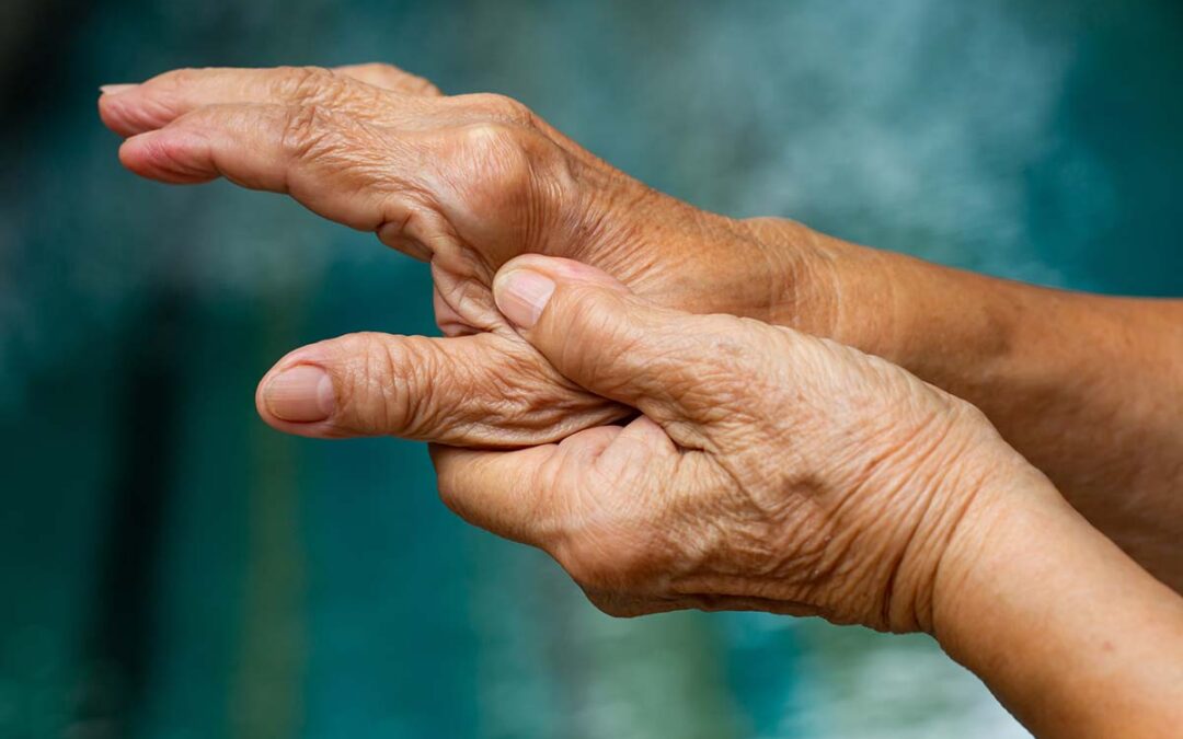 Regulierung des Immunsystems könnte Ausbruch von rheumatoider Arthritis verhindern