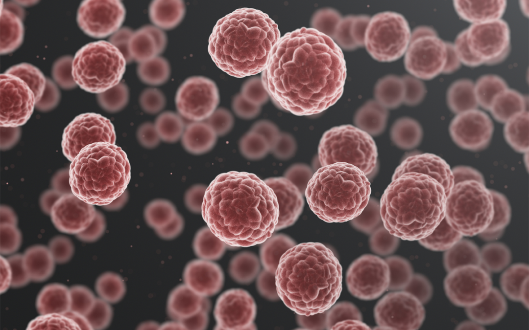 Cholesterin-Vorstufe schützt Krebszellen vor Ferroptose
