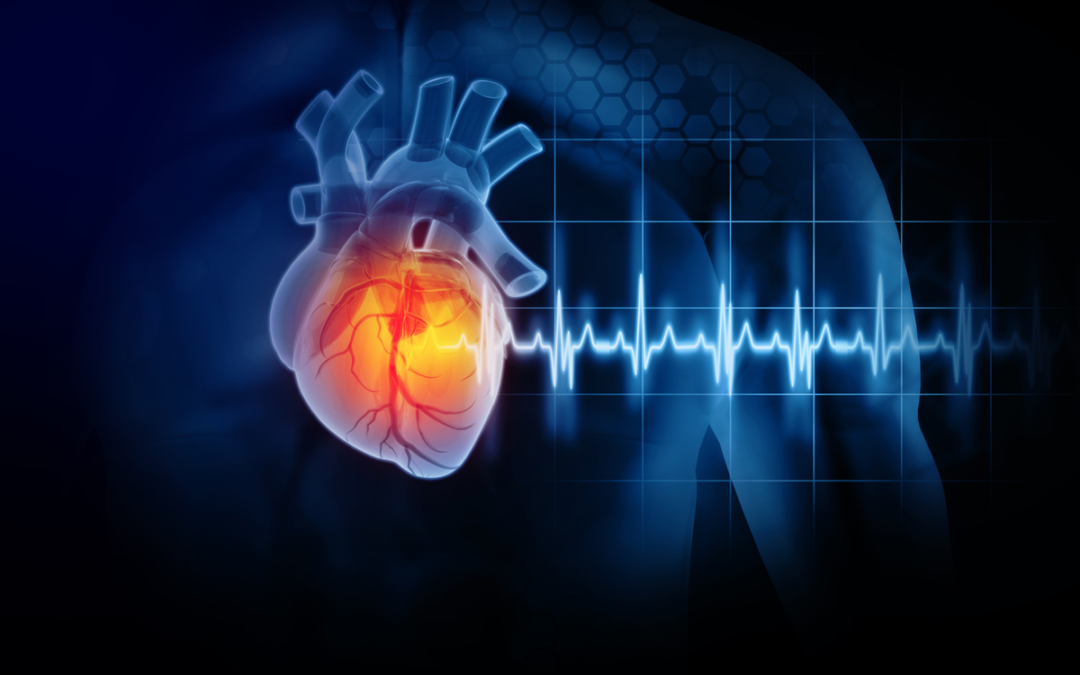Niacin-Überschuss als neuer Herzkrankheit Risikofaktor identifiziert