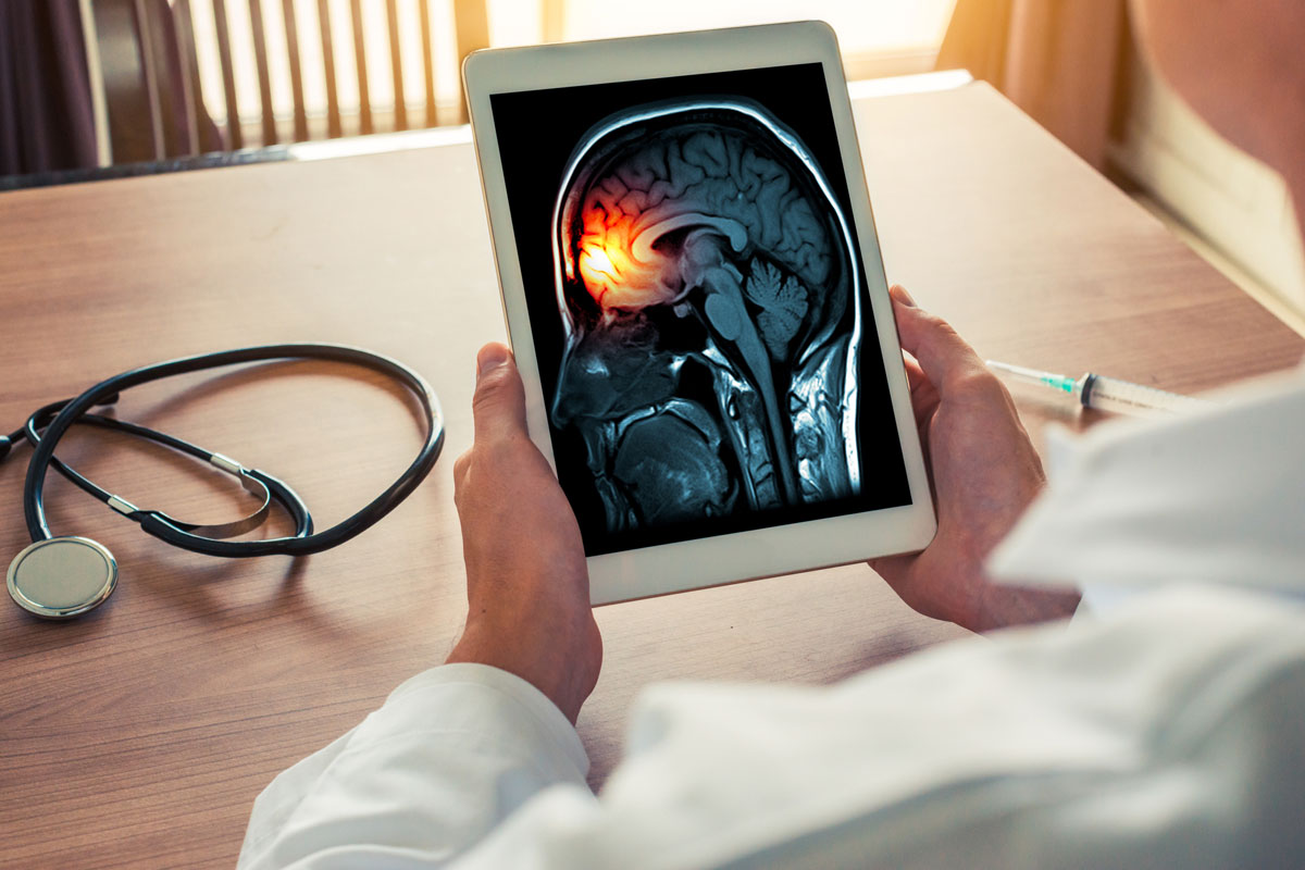 Arzt hält ein digitales Tablet mit der Aufnahme eines Gehirns in der Hand