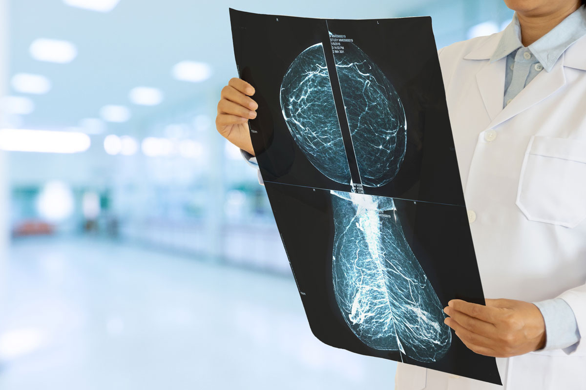 Gynäkologin bei der Überprüfung eines Mammogramms auf Brustkrebs im Krankenhaus